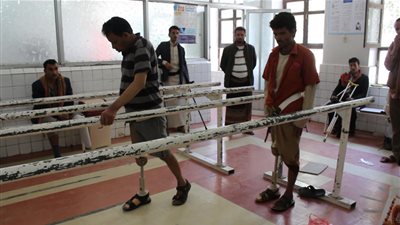 البحث عن ذراع وقدم.. صناعة الأطراف التعويضية تنشط بفعل حرب اليمن