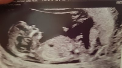 ملاك يحرس جنينا في بطن والدته (صور)