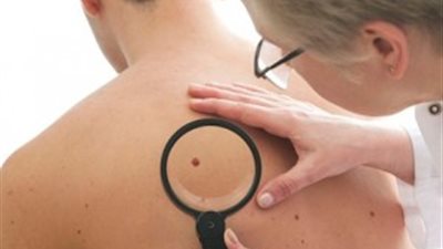 8 أنواع من السرطان تصيب الشباب