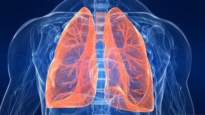 أسباب الإصابة بالجلطة الرئوية وطرق علاجها