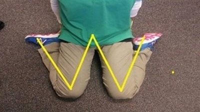 3 أضرار كارثية تهدد عظام طفلك للجلوس بطريقة «W»