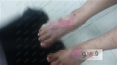 آباء وأمهات جلادين.. أم تعذب طفلتها وتسيطر على بكائها بالترامادول وتحاول بيع كليتها.. حفلات تعذيب لطفلة على يد والدها وزوجته بالمرج.. وربة منزل تحرق نجلتها بالسلام