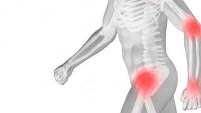 اليوم.. الإعلان عن أول دواء مصري لعلاج «هشاشة العظام» بجرعة واحدة