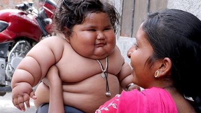 بالصور.. إصابة طفلة «8 أشهر» بالبدانة بسبب شهيتها المفرطة