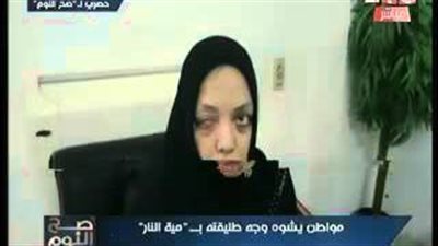 بالفيديو.. مواطن يشوه وجه طليقته لنيتها الزواج من آخر بالشرقية