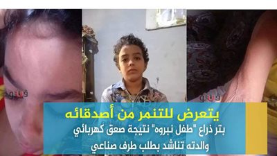 يتعرض للتنمر من أصدقائه.. بتر ذراع 