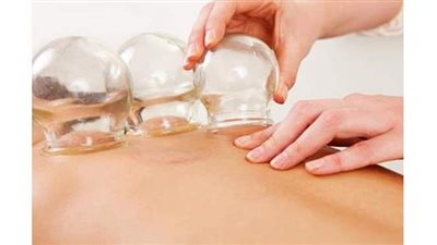 تفسير رؤية الحجامة في المنام وعلاقتها بالخلافات الزوجية والشفاء من الأمراض