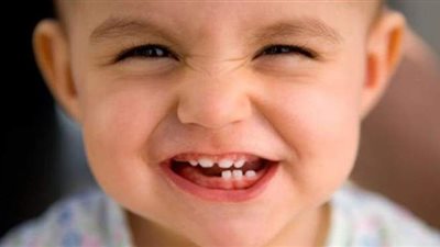 اتبعي هذه النصائح لحماية أسنان طفلك من التسوس