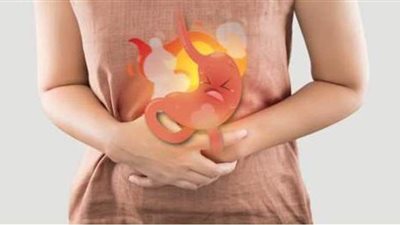 علاج الحموضة الشديدة