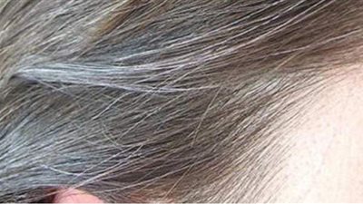 أسباب ظهور الشعر الأبيض وطرق التخلص النهائي منه