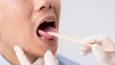 لسان كوفيد..  أحدث الأعراض غير المعتادة لـ كورونا