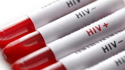 وزارة الصحة: ٤ أسباب للإصابة بمرض الإيدز