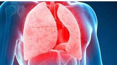 ما لا تعرفه عن مرض الدرن.. وكيف ينتقل ؟