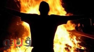 خلع الملابس والإكسسوارات.. نصائح الحكومة للمواطنين عند التعامل مع الحروق