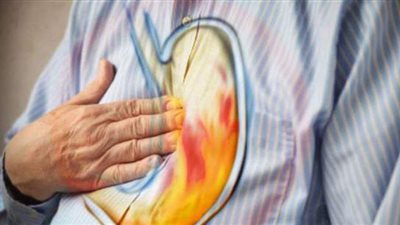 10 وصفات طبيعية تخلصك من الحموضة