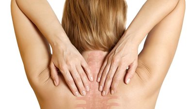 وصفة سحرية تخلصك من هشاشة العظام