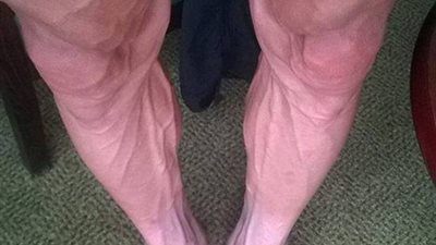 بالصورة.. ساق متسابق دراجات تثير الجدل على الإنترنت