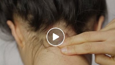 بالفيديو.. أسهل طرق لعلاج الصداع دون تناول الأدوية