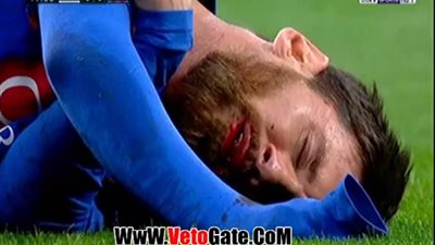 بالفيديو.. إصابة ميسي في كلاسيكو ريـال مدريد وبرشلونة