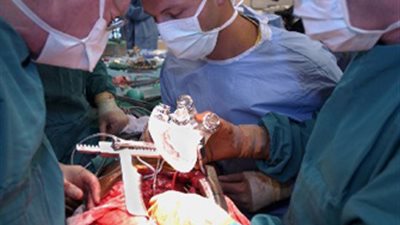 شركات التأمين تنتظر موافقة الرقابة المالية على وثيقة نقل الأعضاء البشرية