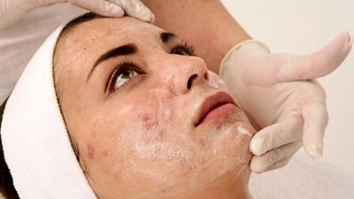 ماسك الدقيق والليمون يقضي على النمش تمامًا