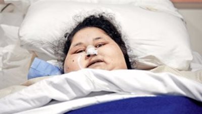 شقيقة أسمن امرأة: الطبيب الهندي استغل حالتها للنصب وجمع التبرعات