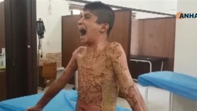 حق محمد.. تحرك دولي ضد أردوغان بعد جريمة حرق الطفل الكردي