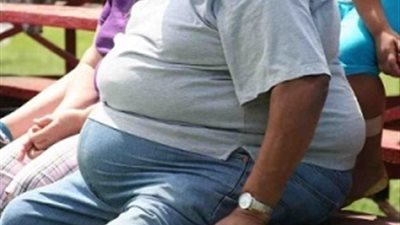 7أسباب تؤدي إلى فشل العلاقة الزوجية بين المصابين بالسمنة