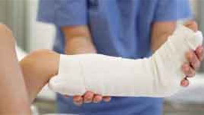 أخصائى عظام يوضح الإسعافات الأولية للتعامل مع كسور العظام
