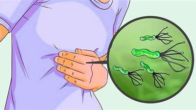 كل ما تود أن تعرفه عن جرثومة المعدة الأعراض والعلاج والوقاية