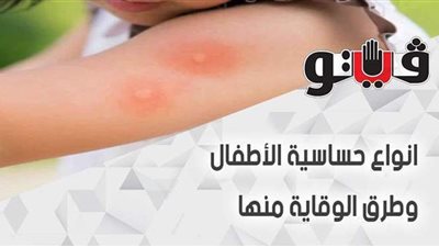 أنواع حساسية الأطفال وطرق الوقاية منها