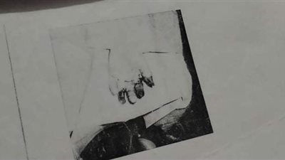 استغاثة لوزير القوى العاملة.. مأساة عم «رضوان».. بتر باليد وضياع مستحقاته