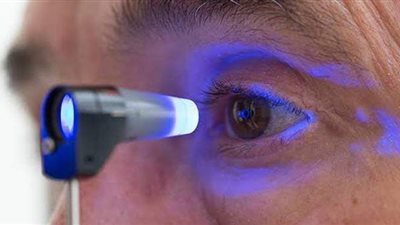 أهم أعراض الإصابة بالمياه الزرقاء في العين