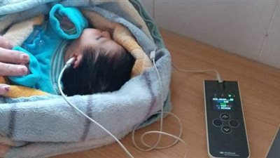 فحص 8412 طفلًا حديث الولادة بالمنيا ضمن مبادرة السمعيات