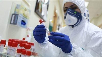 السعودية تسجل 303 إصابات و3 وفيات جديدة بكورونا