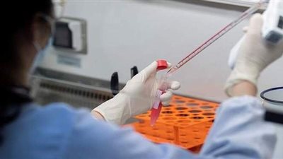 إيطاليا تسجل 13659 إصابة و422 وفاة جديدة بكورونا