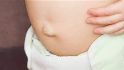 علاج الفتق الأربي والسري لدى الأطفال