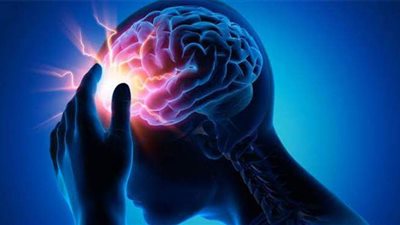 أعراض مرض الصرع وأسبابه