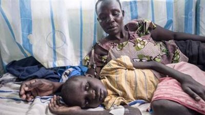 غثيان وتقيؤ دم.. مرض غامض يقتل 15 شخصا ويصيب العشرات في تنزانيا