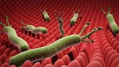 أعراض الجرثومة الحلزونية