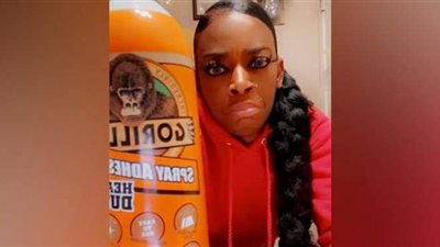 أمريكية تدخل الطوارئ بعد استخدامها الغراء كبديل لمثبت الشعر