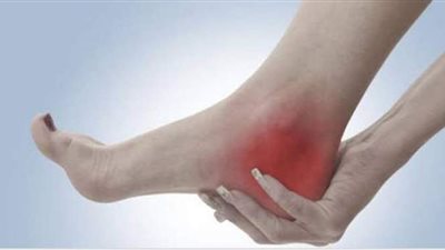 أسباب الإصابة بشوكة الكعب وطرق الوقاية والعلاج