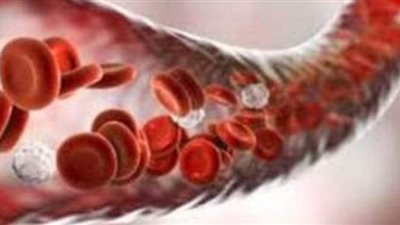 أعراض نقص مخزون الحديد في الجسم