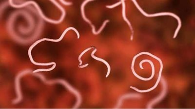 الديدان الدبوسية.. طرق العدوى والوقاية وأهم الأعراض