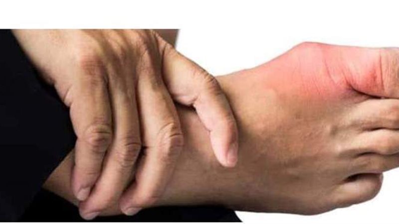 أعراض النقرس