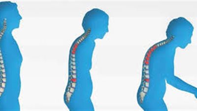 للرجال فقط.. 5 أطعمة تقوي عظامك وتحميك من الهشاشة