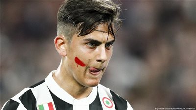 من أجل المرأة.. الدوري الإيطالي بأحمر الشفاه!