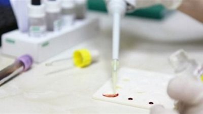 دراسة تكشف طرق تشخيص مرضى خلل الكروموسومات