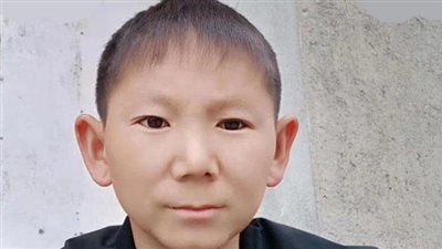 الرجل الطفل.. عمره 34 عاما ومظهره 6 سنوات