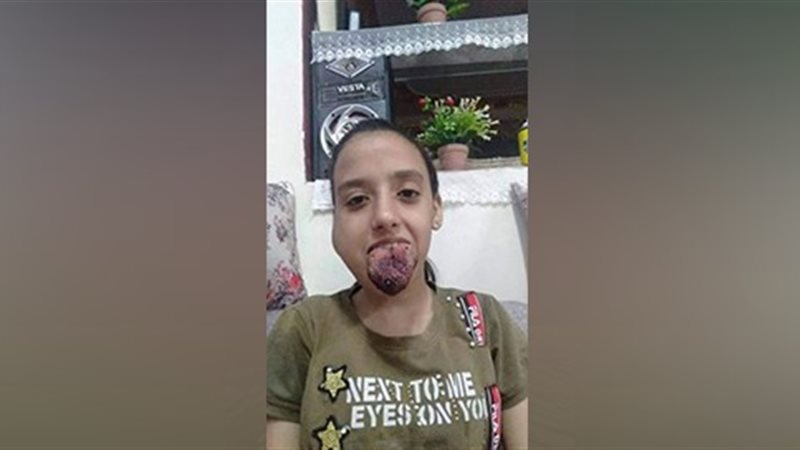 فيتو